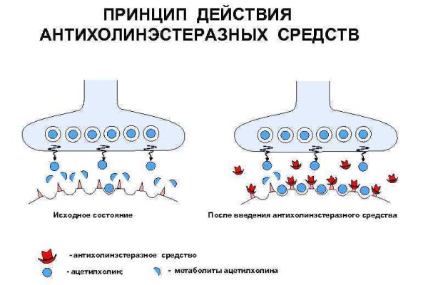 Замена гидры